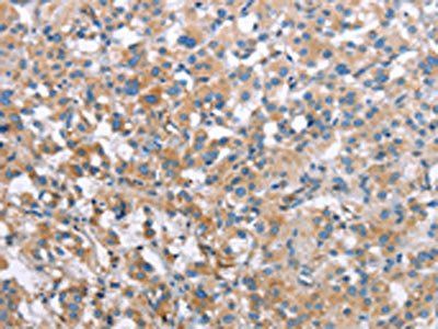 MCL1 Antibody