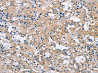 MCL1 Antibody