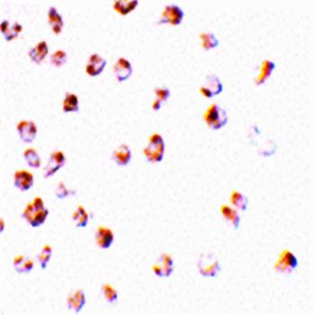Mcl Antibody