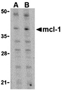 Mcl Antibody
