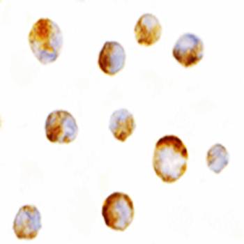Mcl Antibody