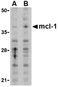 Mcl Antibody