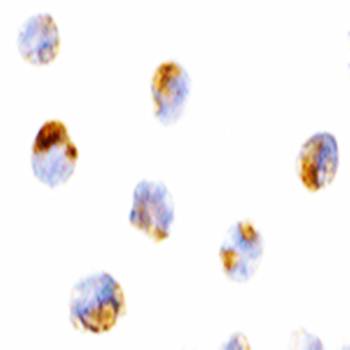 Mcl Antibody