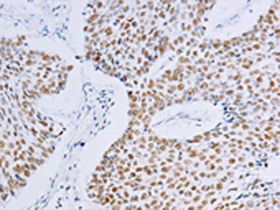 MCM2 Antibody