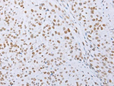 MCM2 Antibody