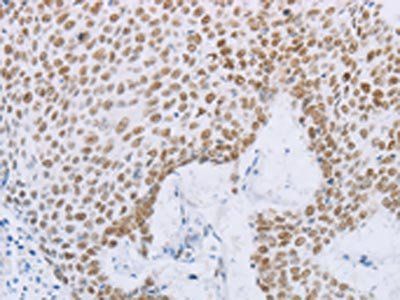 MCM2 Antibody