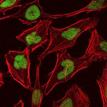 MCM2 Antibody