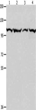 MCM3 antibody