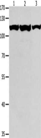 MCM3 antibody