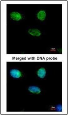 MCM3 Rabbit Polyclonal Antibody