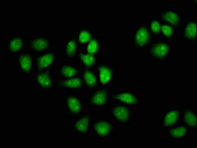 MCM3AP antibody