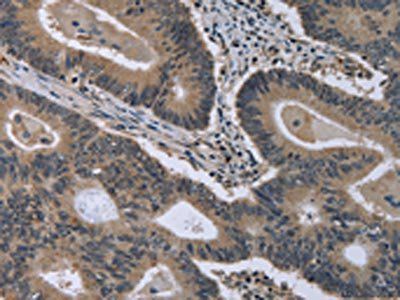 MCM3AP Antibody