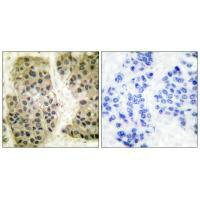 MCM3AP Antibody