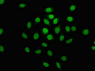 MCM4 antibody