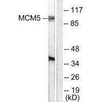 MCM5 antibody