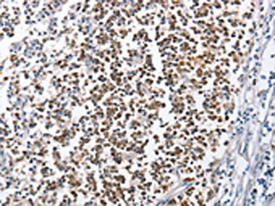 MCM6 Antibody