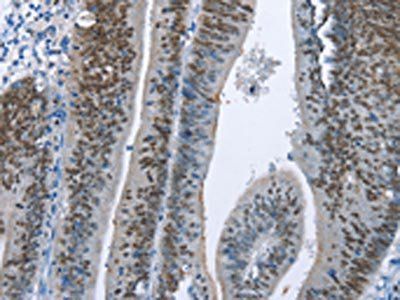 MCM6 Antibody