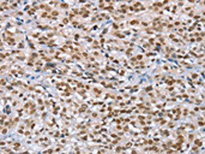 MCM6 Antibody