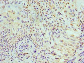 MCM7 Antibody