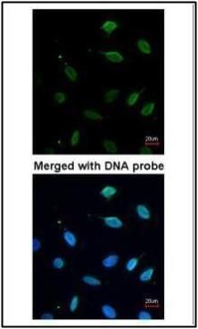 MCM7 antibody