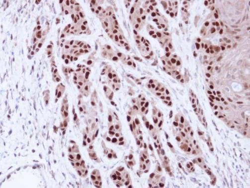 MCM7 antibody [N2C2], Internal