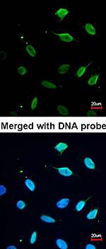 MCM7 antibody