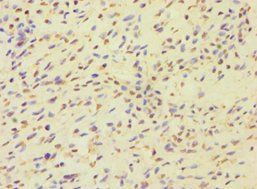 MCMBP Antibody