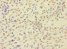 MCMBP antibody