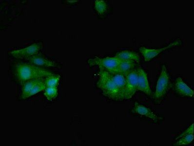 CCL2 Antibody