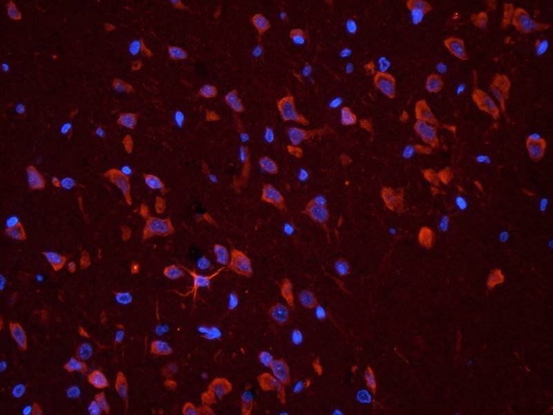 MCP1 antibody