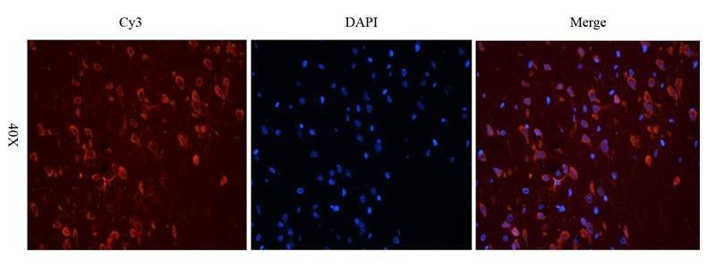 MCP1 antibody