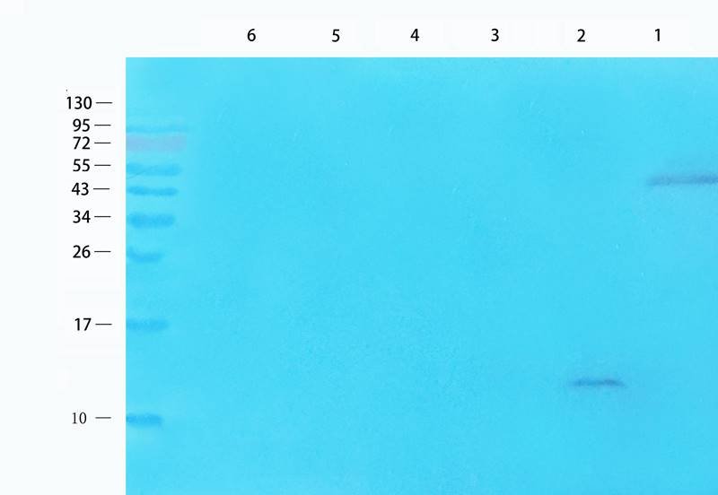 MCP1 antibody