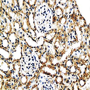 MCP2/CCL8 antibody