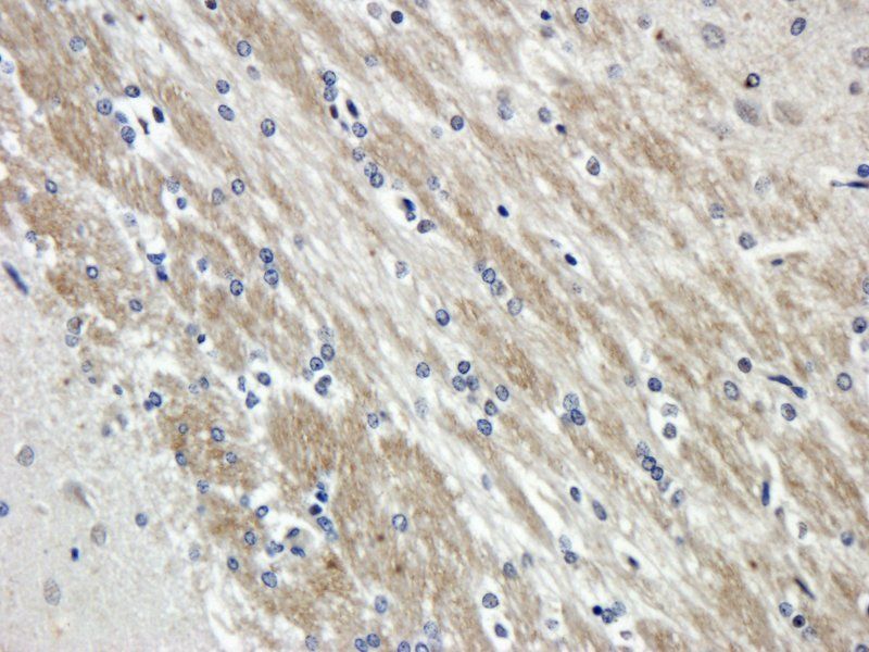 MCP3/CCL7 antibody