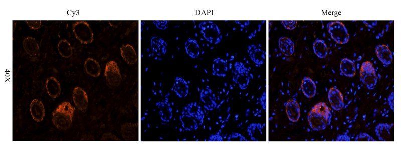 MCP3 antibody