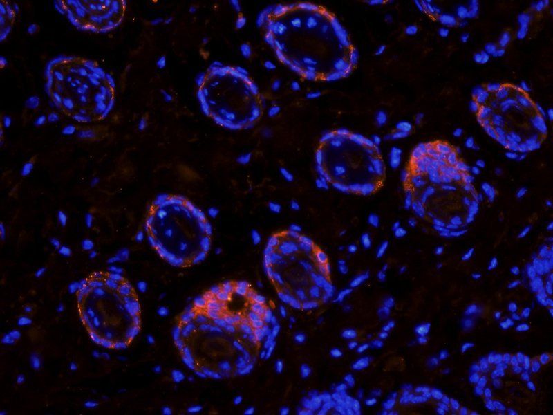 MCP3 antibody