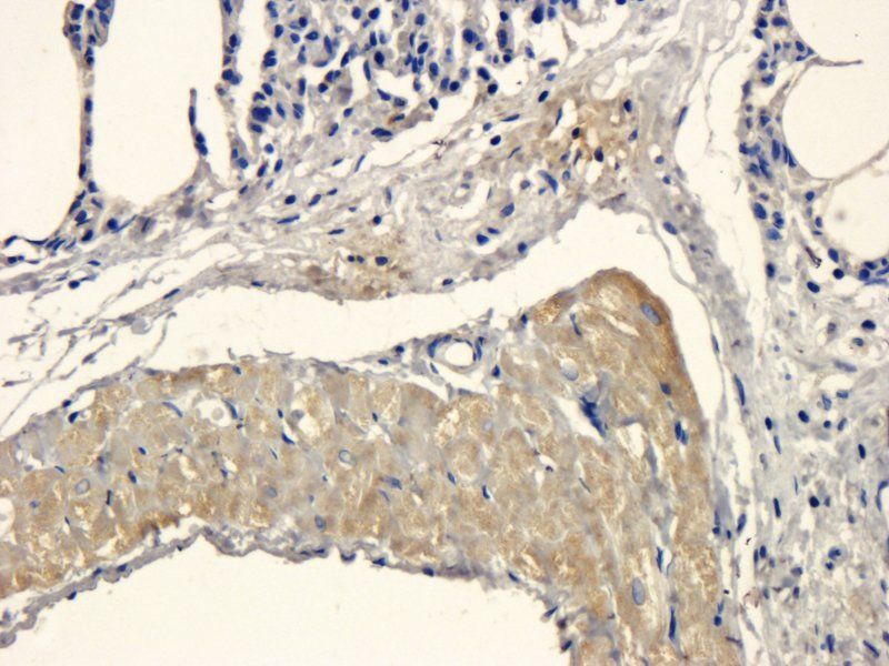 MCP5 antibody