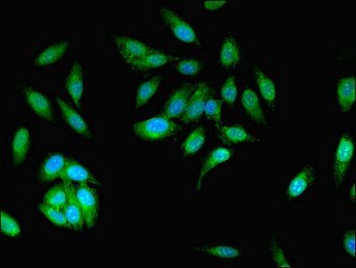MCPH1 Antibody