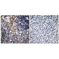MCPH1 Antibody