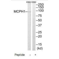 MCPH1 Antibody