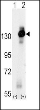 MCSF Receptor antibody