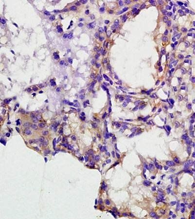 CSF1 Rabbit Polyclonal Antibody