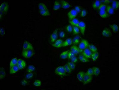 MCTP2 Antibody