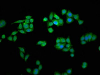 MCTS1 Antibody