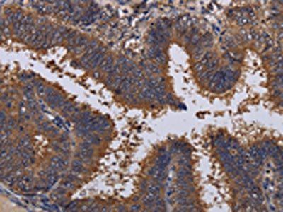 MCTS1 Antibody