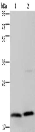 MCTS1 Antibody