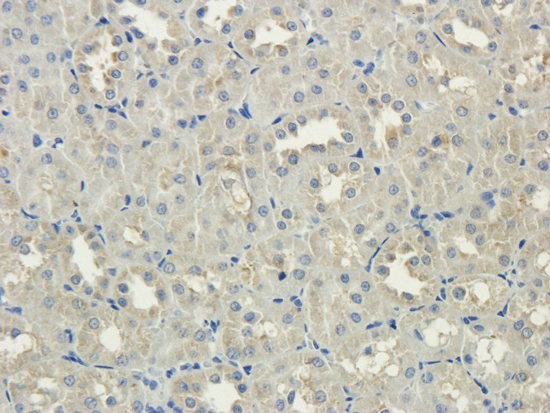 MCU antibody