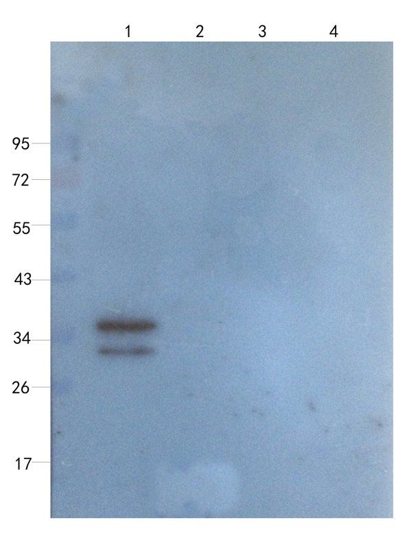 MCU antibody