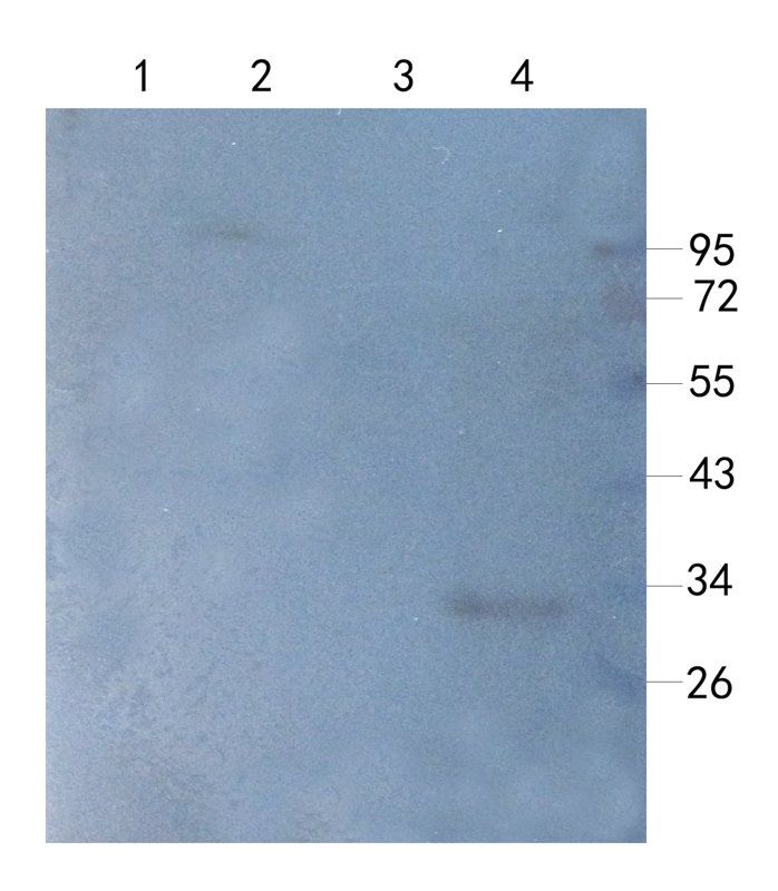 MCU antibody