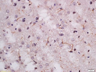MDGA2 Rabbit Polyclonal Antibody